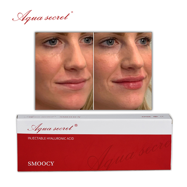 1ml Hyaluronic Acid Filler Lips Buy Online