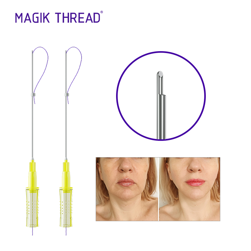 Types of Protein Threads for Face Lifting 