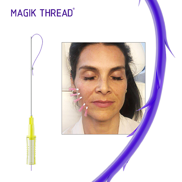 Types of Protein Threads for Face Lifting 