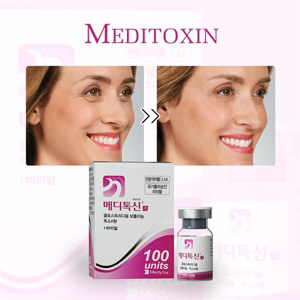 botulinum toxin injection 