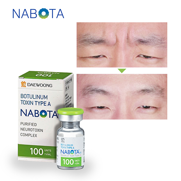 Nabota Botox for Sale
