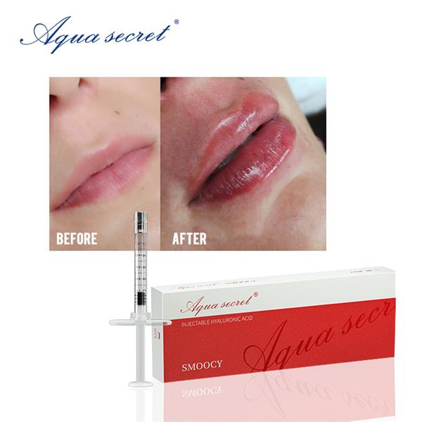 Hyaluronic Acid Lip Filler Buy Hyaluronic Acid Lip Filler Hyaluronic Acid Lip Fillerfor Sale