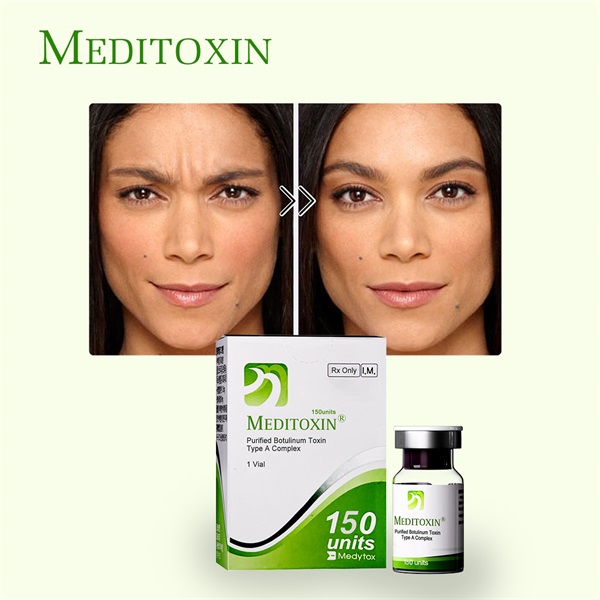botulinum toxins
