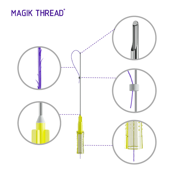 All Types of Pdo Thread Lift Cog Threads 27g Pdo